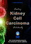 Kidney Cell Carcinoma【電子書籍】[ Lothar Hirneise ]