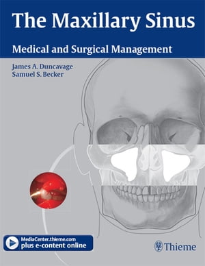 The Maxillary Sinus Medical and Surgical Management