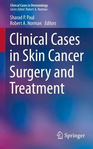Clinical Cases in Skin Cancer Surgery and Treatment【電子書籍】 1