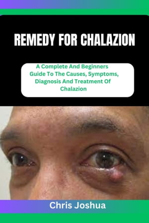 REMEDY FOR CHALAZION