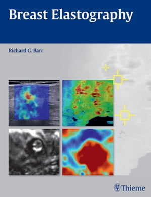Breast Elastography【電子書籍】[ Richard G. Barr ]