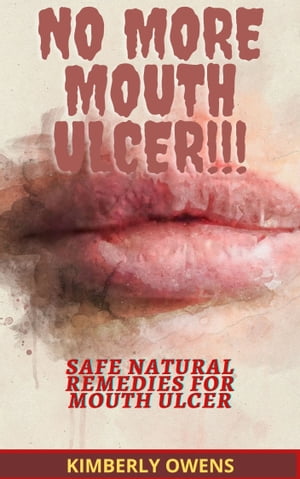 NO MORE MOUTH ULCERS