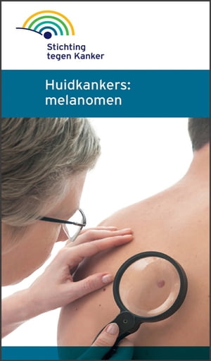 Melanomen en huidkanker