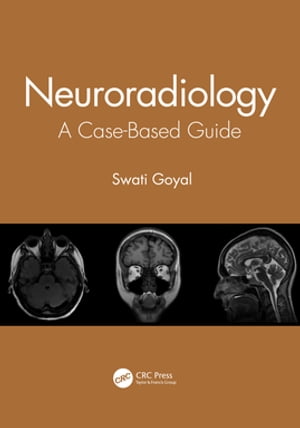 Neuroradiology