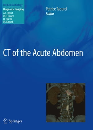 CT of the Acute Abdomen