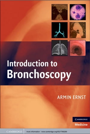 Introduction to Bronchoscopy