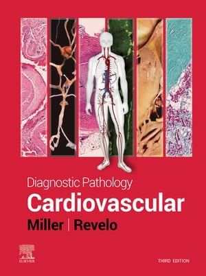 Diagnostic Pathology: Cardiovascular【電子書籍】 Dylan V. Miller, MD