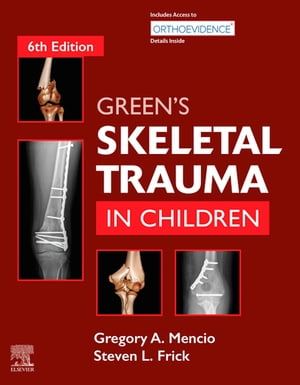 Green's Skeletal Trauma in Children E-Book