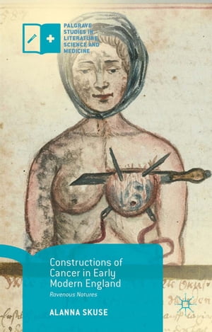 Constructions of Cancer in Early Modern England