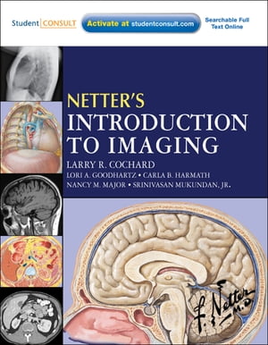 Netter's Introduction to Imaging E-Book