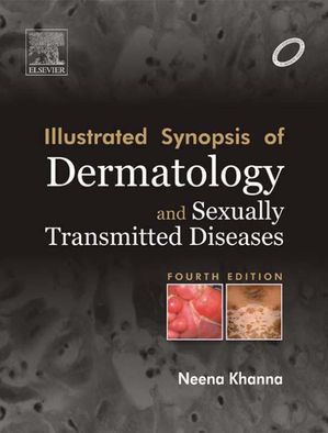 ŷKoboŻҽҥȥ㤨Illustrated Synopsis of Dermatology & Sexually Transmitted Diseases - E-bookŻҽҡ[ Neena Khanna ]פβǤʤ1,748ߤˤʤޤ