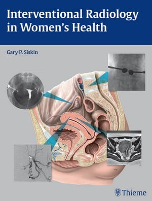 Interventional Radiology in Women's Health