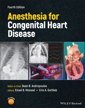 Anesthesia for Congenital Heart Disease