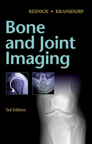 Bone and Joint Imaging