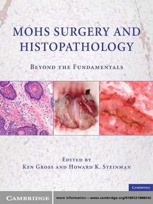 Mohs Surgery and Histopathology