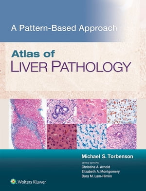 Atlas of Liver Pathology: A Pattern-Based Approach【電子書籍】 Michael Torbenson