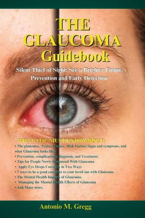 The Glaucoma Guide Book Silent Thief of Sight