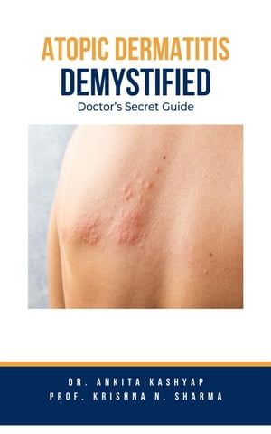 Atopic Dermatitis Demystified: Doctor's Secret Guide