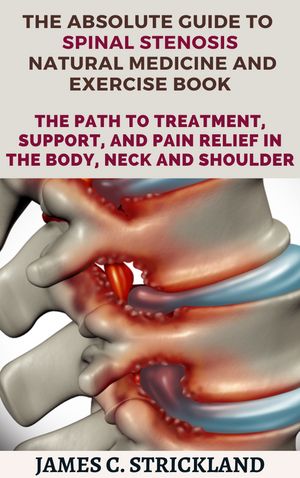 The Absolute Guide to spinal stenosis natural medicine and exercise book The path to treatment, support, and pain relief in the body, neck and shoulder