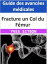 Fracture un Col du Fémur : Guide des avancées médicales