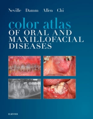 Color Atlas of Oral and Maxillofacial Diseases