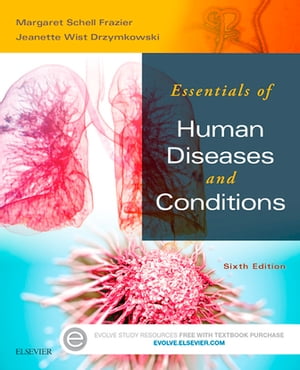 Essentials of Human Diseases and Conditions - E-Book Essentials of Human Diseases and Conditions - E-Book