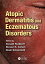 Atopic Dermatitis and Eczematous Disorders