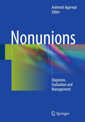 ＜p＞Providing a comprehensive presentation of the diagnosis, evaluation and management of nonunions, this generously illustrated text details the current principles, surgical techniques and approaches with these challenging clinical situations. Since each nonunion can be fairly particular, the treatment regimens provide guidelines to effectively approach such problems. Opening with a discussion of the principles of nonunions and fracture healing, the remainder of the book is divided by anatomical area and provides evidence-based recommendations, case examples, and preferred treatment/algorithms for both the upper and lower extremities, including the clavicle, the proximal humerus, proximal femur, and tibial plateau, as well as the pelvis and acetabulum. Specialized circumstances are also discussed, including periprosthetics and joint replacement.＜/p＞ ＜p＞Although not every single treatment option is described for every single anatomical area and type of injury, ＜em＞Nonunions＜/em＞ is an excellent resource for orthopedic trauma surgeons, residents and students, not only for managing these common yet complex problems but also in preventing nonunions from occurring by avoiding surgical causes and mitigating patient risk factors.＜/p＞画面が切り替わりますので、しばらくお待ち下さい。 ※ご購入は、楽天kobo商品ページからお願いします。※切り替わらない場合は、こちら をクリックして下さい。 ※このページからは注文できません。