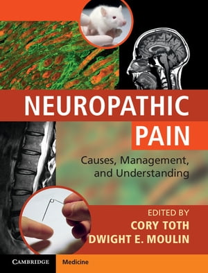 ŷKoboŻҽҥȥ㤨Neuropathic Pain Causes, Management and UnderstandingŻҽҡۡפβǤʤ20,449ߤˤʤޤ