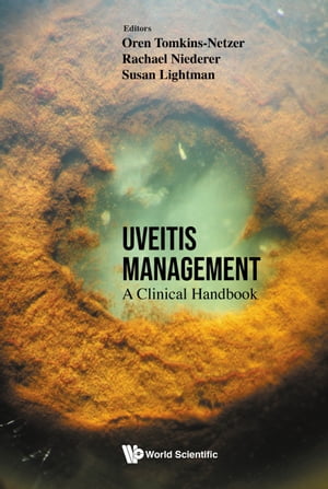 Uveitis Management