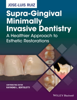 Supra-Gingival Minimally Invasive Dentistry A Healthier Approach to Esthetic Restorations【電子書籍】 Jose-Luis Ruiz