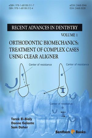 Orthodontic Biomechanics: Treatment Of Complex Cases Using Clear Aligner