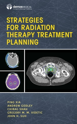 Strategies for Radiation Therapy Treatment Planning【電子書籍】