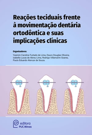 Reações teciduais frente à movimentação dentária ortodóntica e suas implicações clínicas