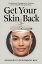 Get Your Skin Back