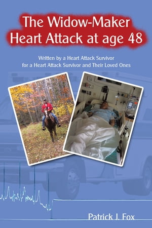 The Widow-Maker Heart Attack at Age 48