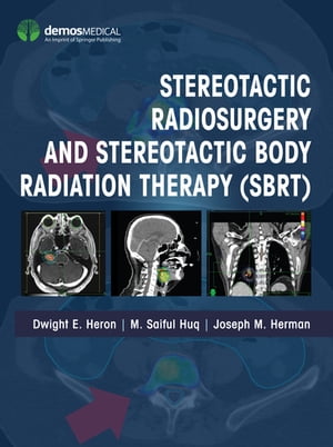 Stereotactic Radiosurgery and Stereotactic Body Radiation Therapy (SBRT)【電子書籍】