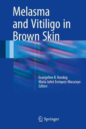 Melasma and Vitiligo in Brown Skin【電子書籍】