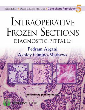 Intraoperative Frozen Sections Diagnostic Pitfalls【電子書籍】[ Pedram Argani, MD ]