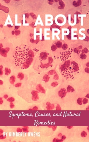 ALL ABOUT HERPES