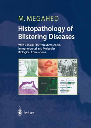 Histopathology of Blistering Diseases With Clinical, Electron Microscopic, Immunological and Molecular Biological Correlations Textbook and Atlas【電子書籍】 Mosaad Megahed