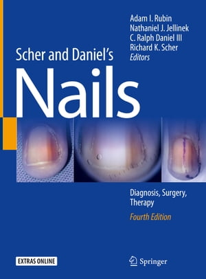 Scher and Daniel's Nails Diagnosis, Surgery, Therapy【電子書籍】
