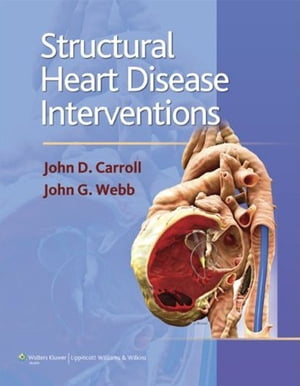 Structural Heart Disease InterventionsŻҽҡ[ John D. Carroll ]