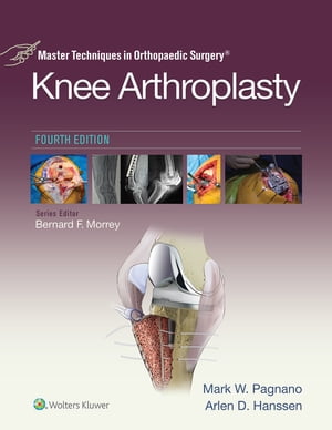 Master Techniques in Orthopedic Surgery: Knee Arthroplasty【電子書籍】[ Mark W. Pagnano ]