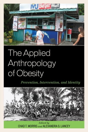 The Applied Anthropology of Obesity