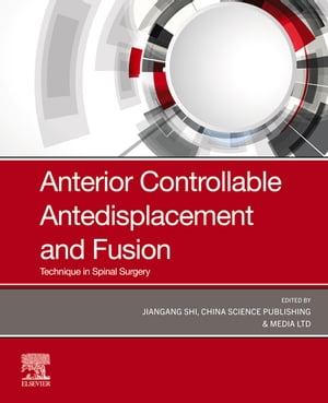 Anterior Controllable Antedisplacement and Fusion (ACAF)