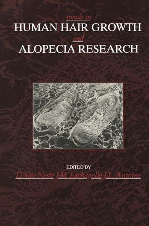 Trends in Human Hair Growth and Alopecia Research