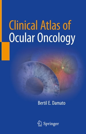 Clinical Atlas of Ocular Oncology