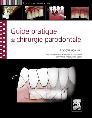 Guide pratique de chirurgie parodontale