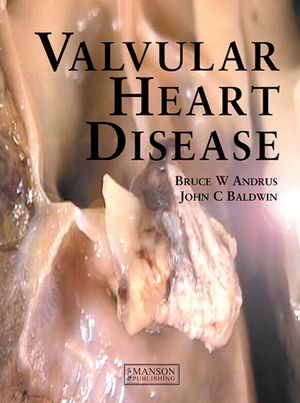 ŷKoboŻҽҥȥ㤨Valvular Heart DiseaseŻҽҡ[ Bruce Andrus ]פβǤʤ11,722ߤˤʤޤ